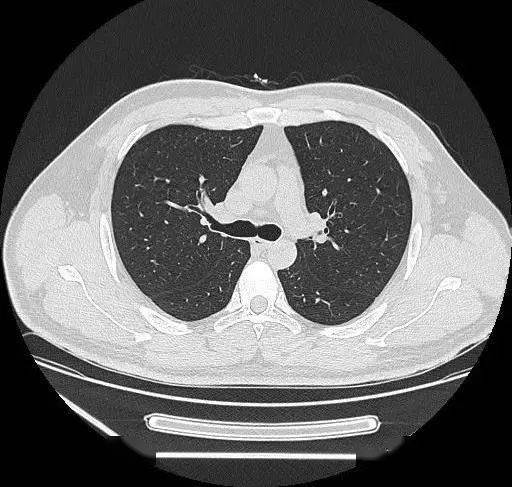 澳门最精准正最精准龙门蚕,深入研究解释定义_CT57.326